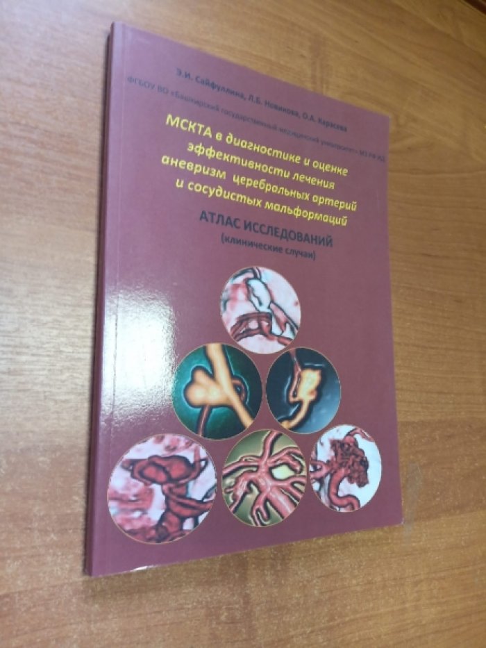Сайфуллина Э.И., Новикова Л.Б., Карасева О.А. МСКТА в диагностике и оценке эффективности лечения аневризм цебральных артерий и сосудистых мальформаций.