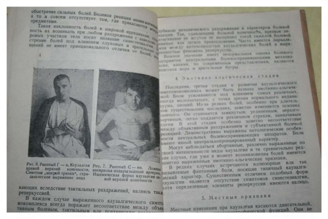 Бондарчук А.В. Каузалгия и ее хирургическое лечение.