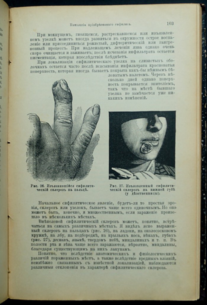 Учебник половых болезней. Венерические заболевания: этиология, симптомы, патология и лечение