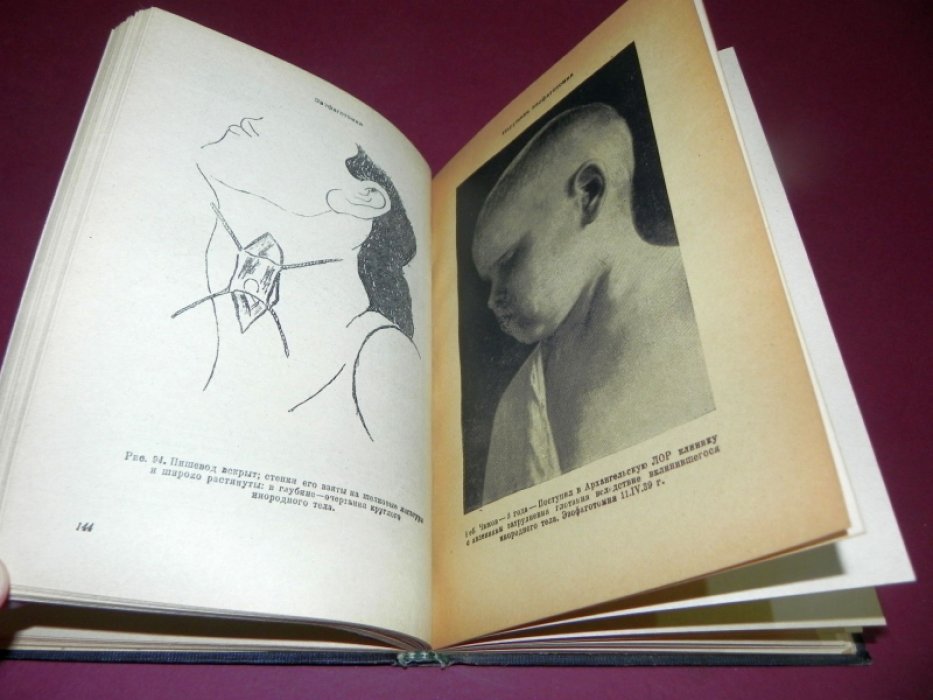 Михелович М.С. Оперативная ЛОР хирургия.