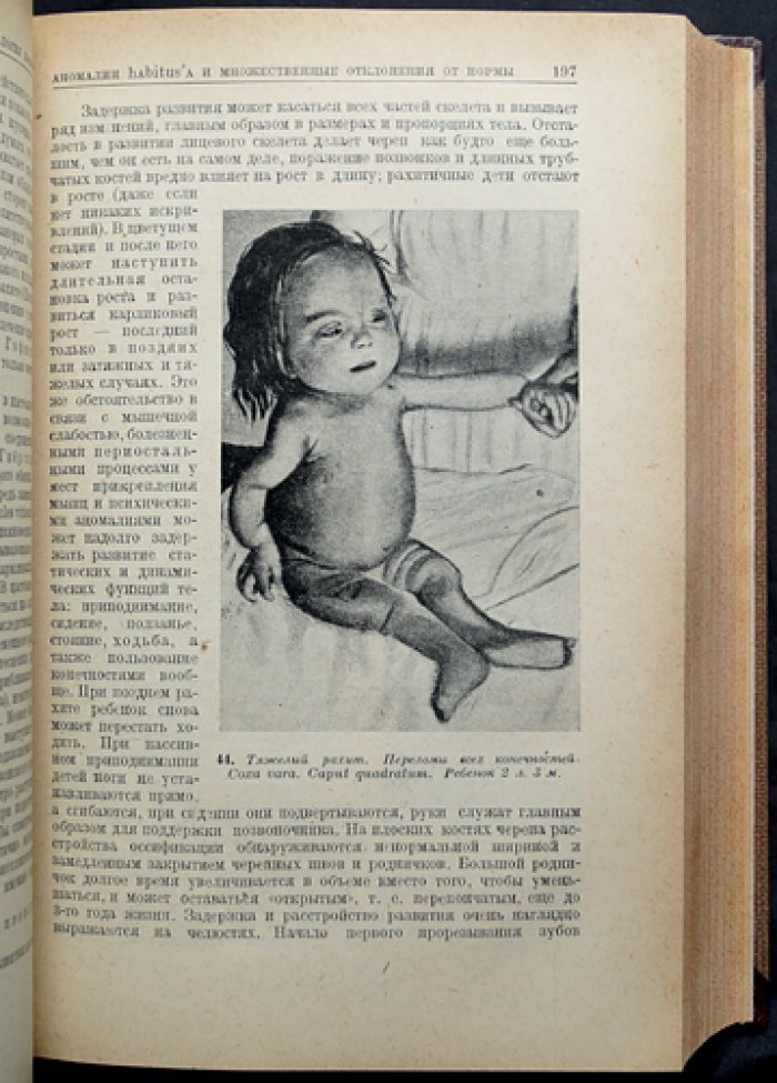 Феер. Руководство по детским болезням (педиатрия) — иллюстрированное издание, перевод с немецкого, редакция Колтыпина и Вейнберга, 1930