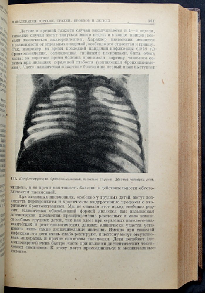 Феер. Руководство по детским болезням (педиатрия) — иллюстрированное издание, перевод с немецкого, редакция Колтыпина и Вейнберга, 1930