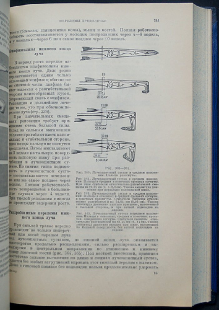 Техника лечения переломов костей (практическое руководство по травматологии)