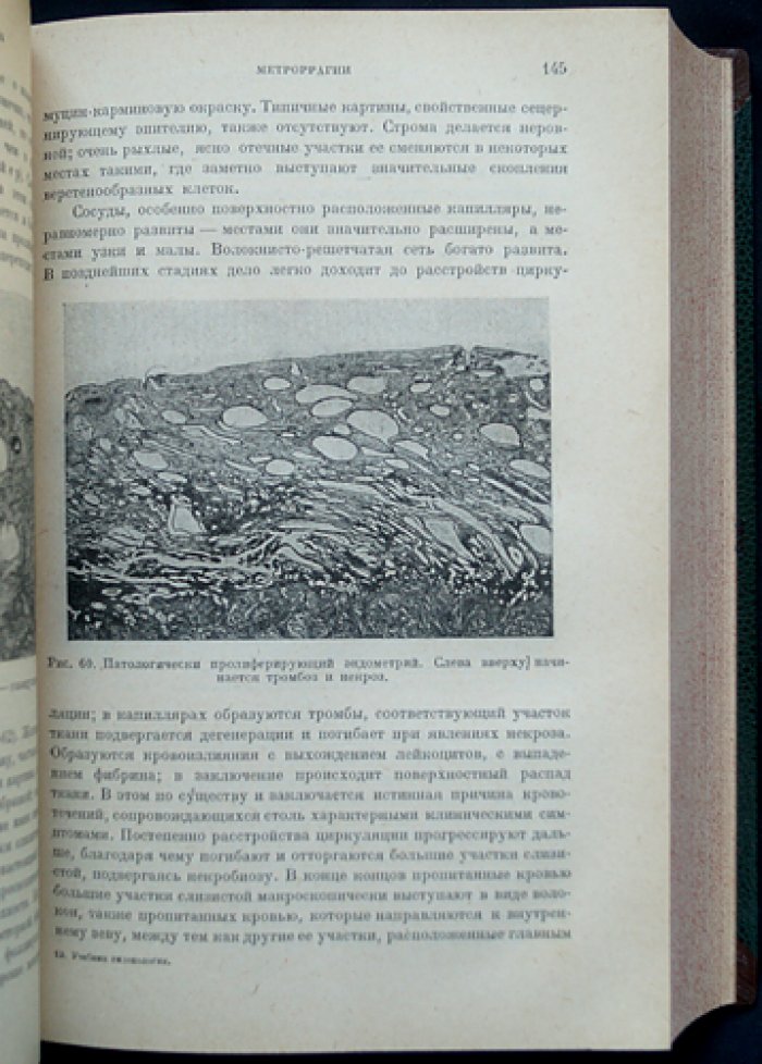 Учебник гинекологии. Патогенетический подход (перевод с немецкого)