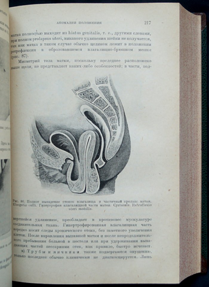 Учебник гинекологии. Патогенетический подход (перевод с немецкого)