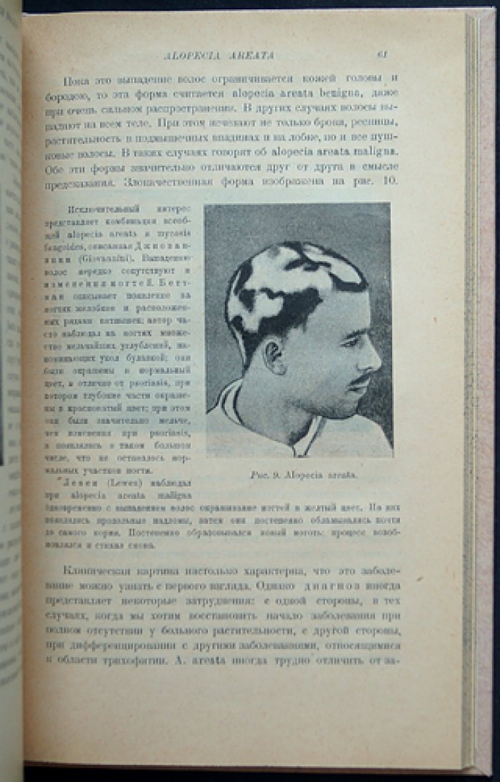 Макс Йозеф. Болезни волос: дерматологический справочник