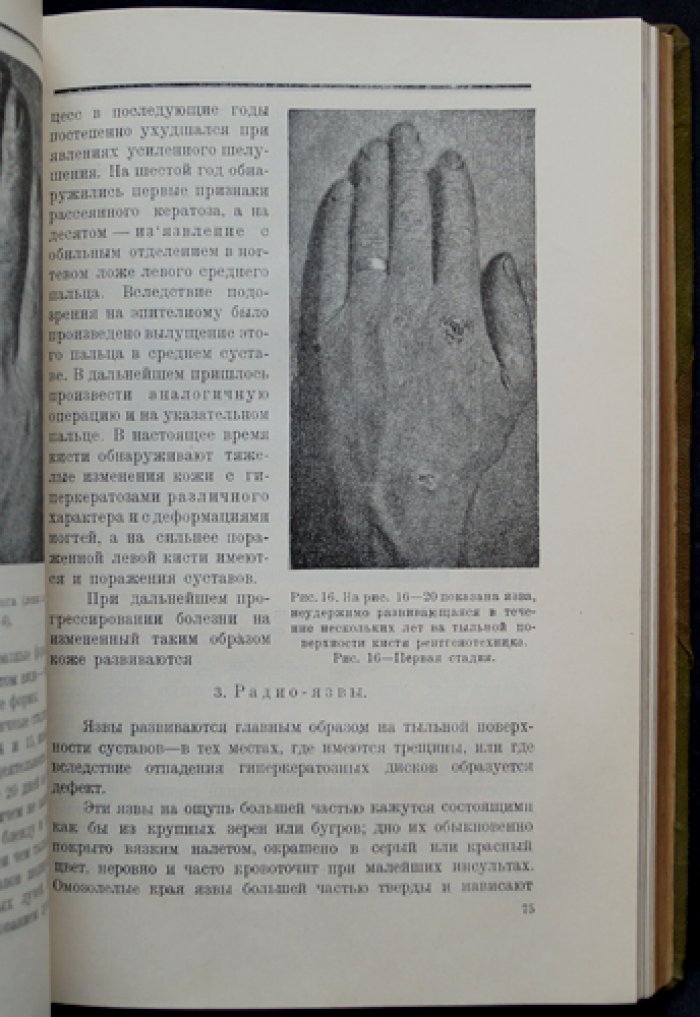 Профессиональные болезни кожи. Том I. В трех выпусках (полный комплект)
