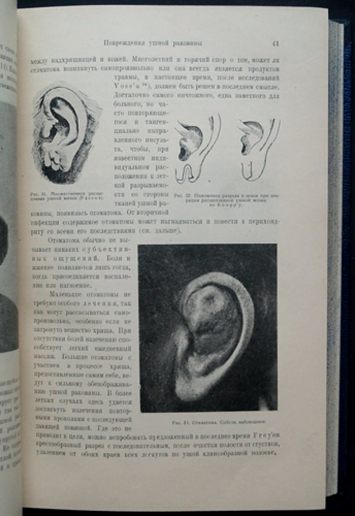 Хирургические болезни уха. Руководство по отохирургии (анатомия, клиника, оперативное лечение)
