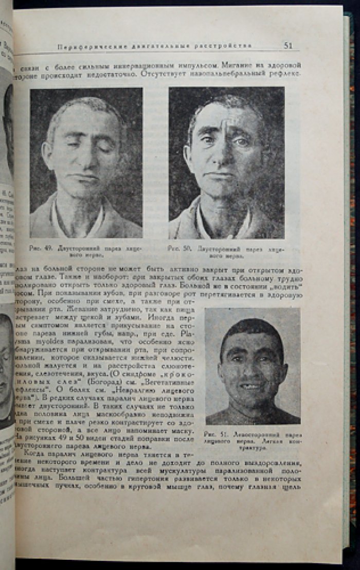 Невропатологические синдромы: клинические наблюдения и систематизация