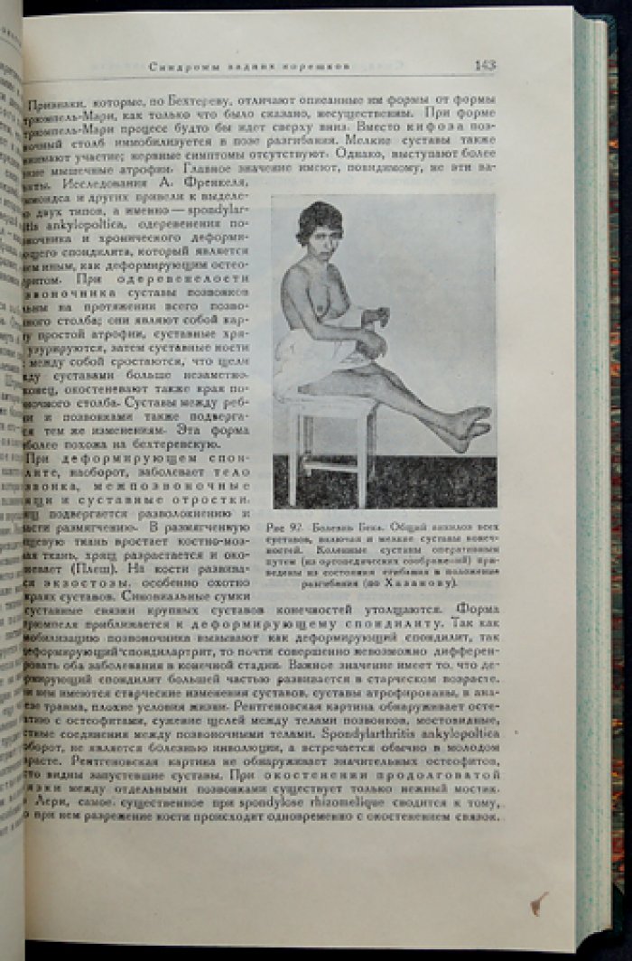 Невропатологические синдромы: клинические наблюдения и систематизация