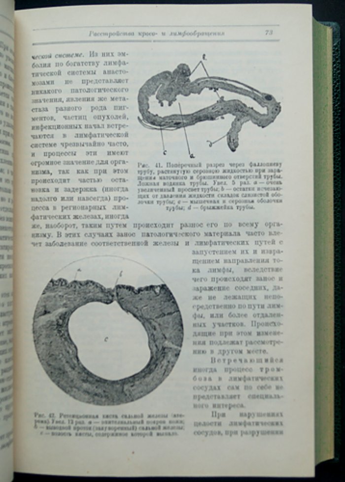 Основы патологической анатомии. В двух частях (общая патологическая анатомия)