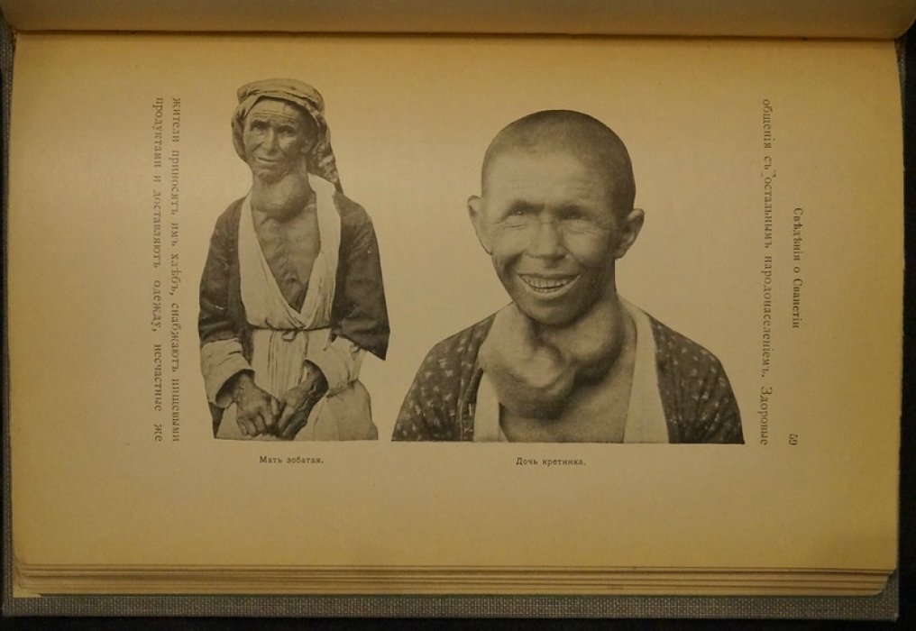 Зоб и кретинизм в Сванетии: медицинское исследование (1904)