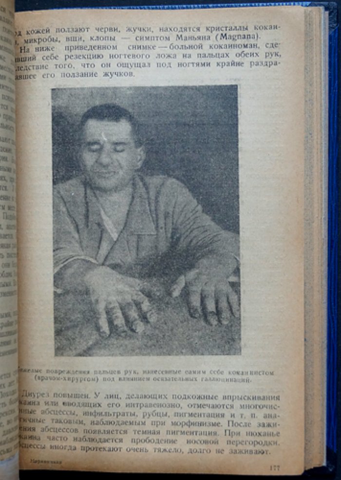 Клиника и терапия наркоманий (по материалам больничной и внебольничной помощи)