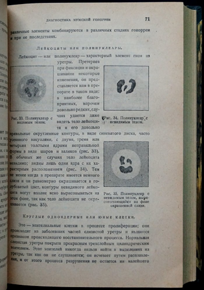 Жюль Жанэ. Диагностика и лечение гонореи у мужчин и женщин