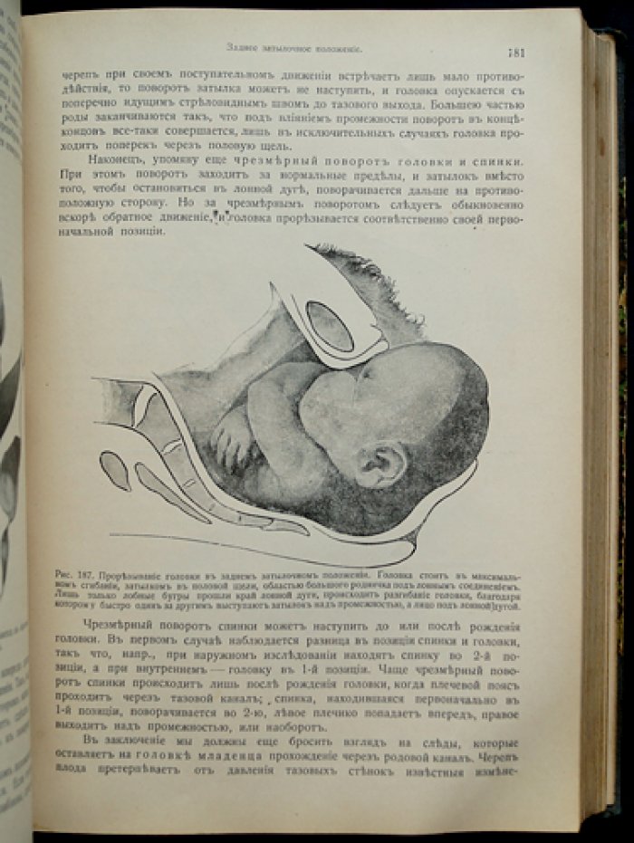 Бумм. Руководство к изучению акушерства: классическое учение о беременности и родах