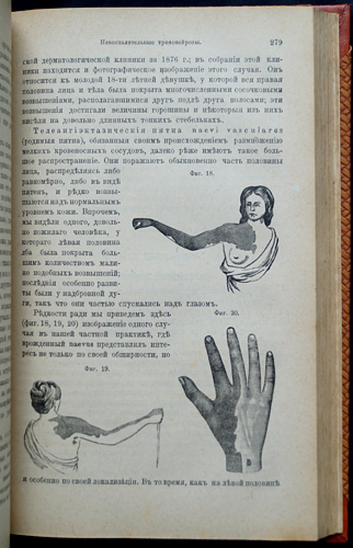 Гебра. Болезненные изменения кожи и её придатков. Клинические и системные взаимосвязи