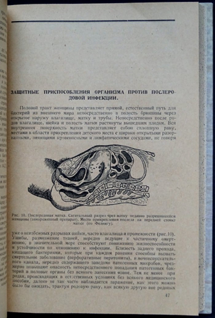 Руководство к изучению лихорадочных послеродовых заболеваний (второе, исправленное и дополненное издание)