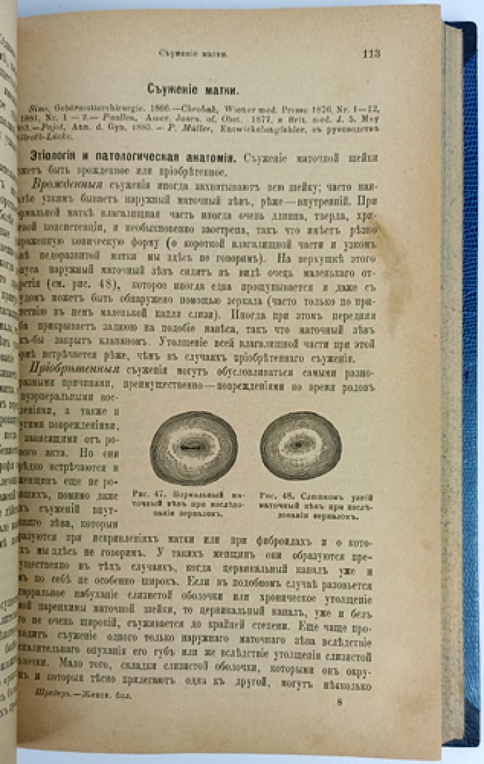 Шредер. Болезни женских половых органов: руководство по гинекологической патологии и терапии