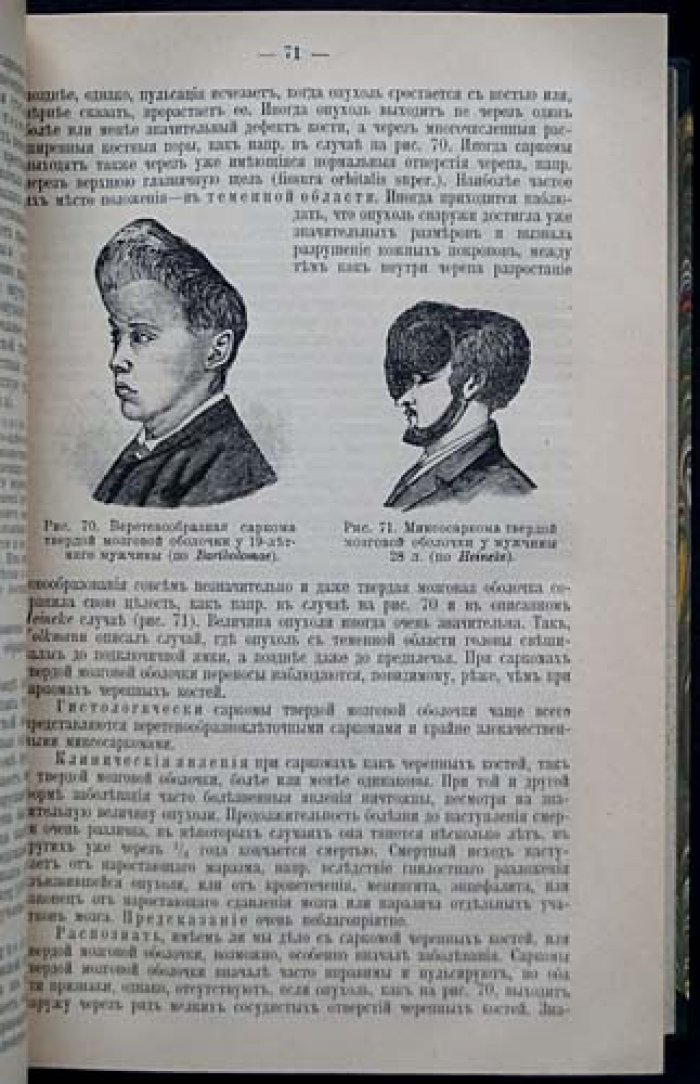 Руководство по частной хирургии (в двух томах): хирургия головы, шеи, груди, позвоночника, живота и конечностей