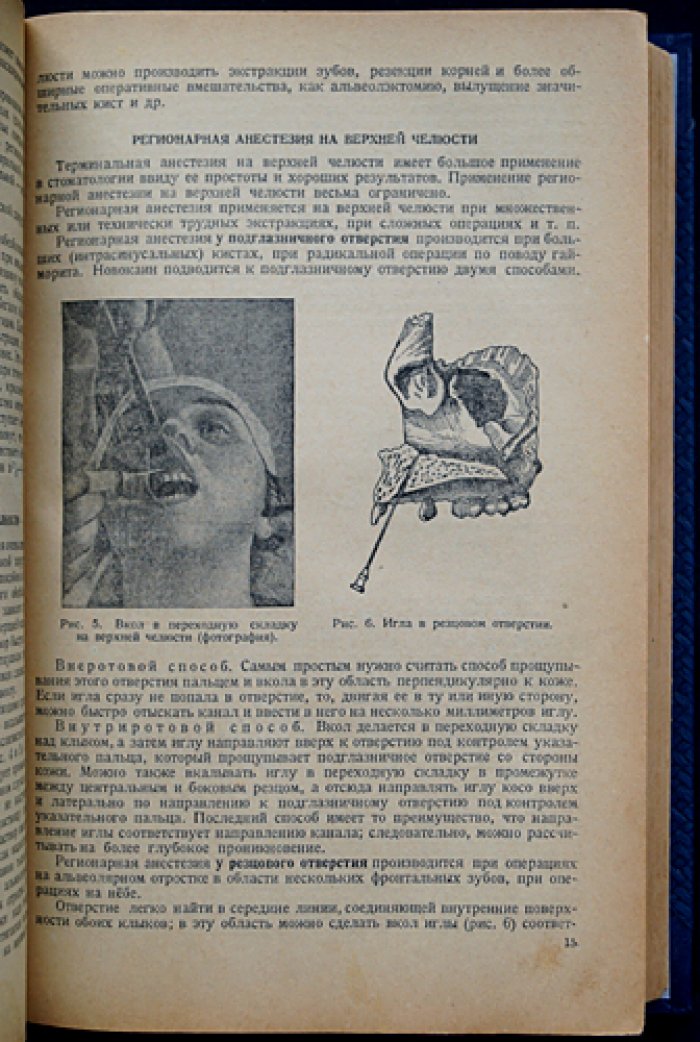 Учебник хирургической стоматологии (1938) — наркоз, экстракция, воспаления, травмы и врожденные патологии лица