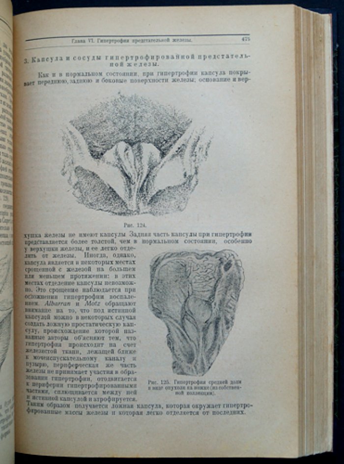 Хольцов Б. Н. Частная урология: собрание в 5 выпусках (Ленинград, 1927–1928)