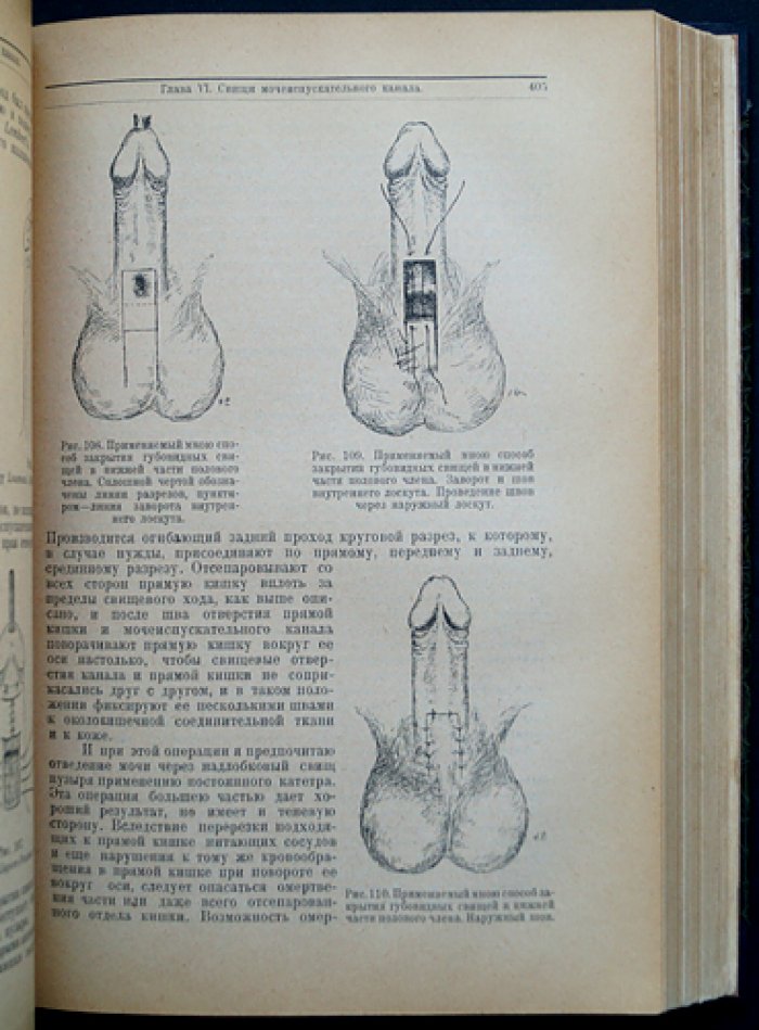 Хольцов Б. Н. Частная урология: собрание в 5 выпусках (Ленинград, 1927–1928)