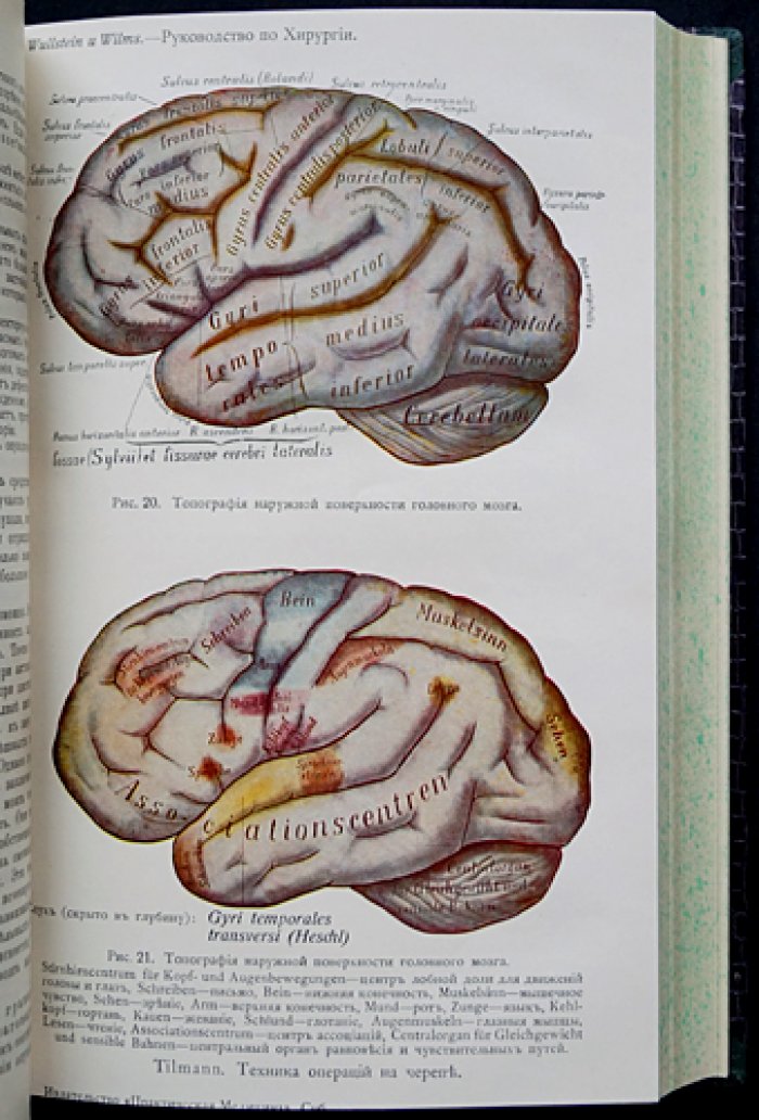 Вулльштейн и Вильмс. Руководство по хирургии. Трёхтомное издание (1913)