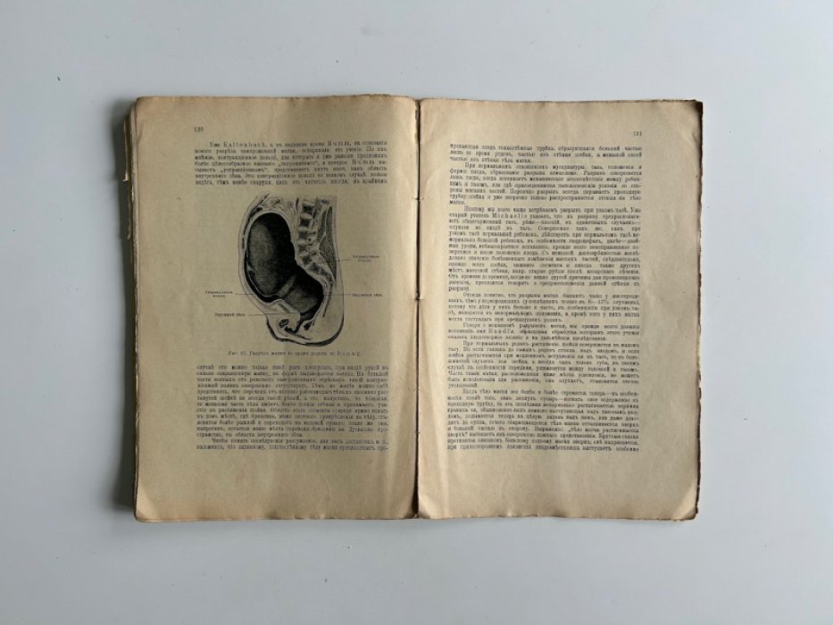 Фелинг Г. Оперативное акушерство в частной практике и клинике.