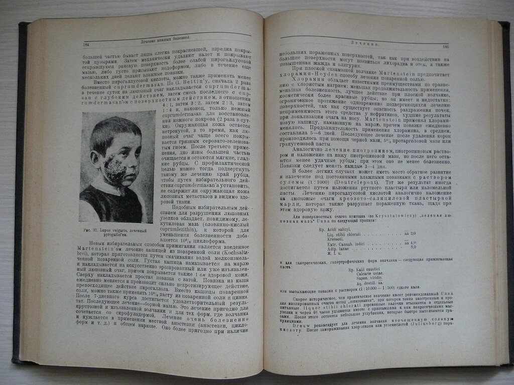 Лидерман Р. Лечение кожных и половых болезней.