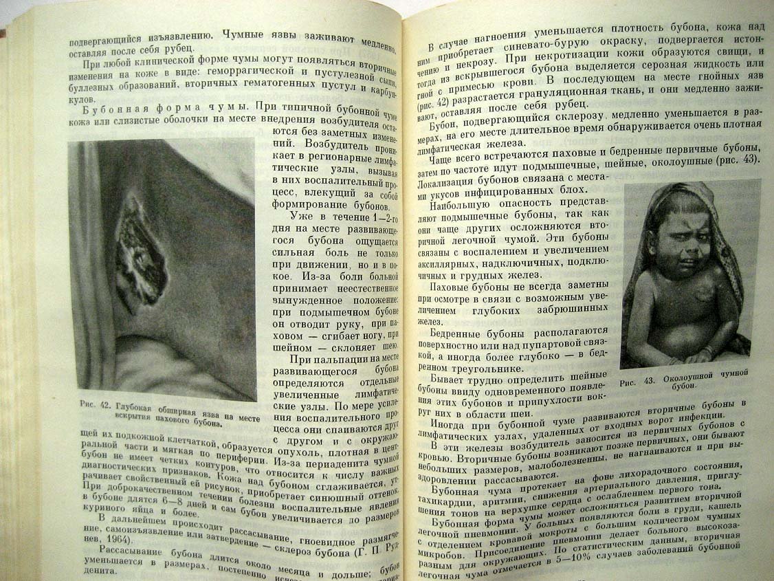 Шувалова Е. Тропические болезни.