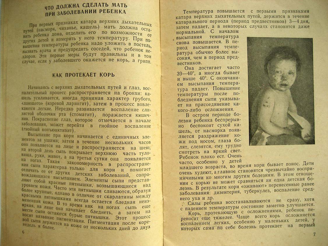 Ливамова Л. Корь и ее предупреждение.