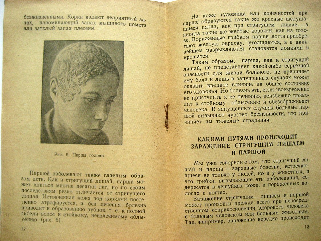 Ариевич А. Грибковые заболевания кожи. Стригущий лишай и парша