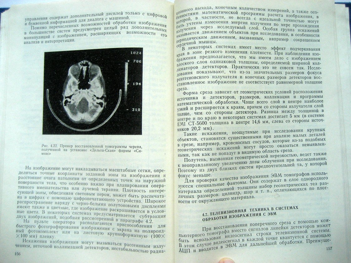 Блинов Н., Жуков Е., Козловский Э. и др. Телевизионные методы обработки рентгеновских и гамма-изображений.