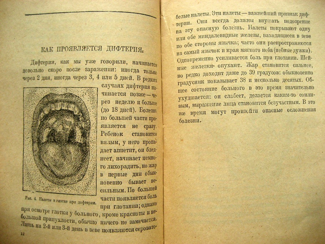 Соловьев В. Дифтерия и борьба с ней.