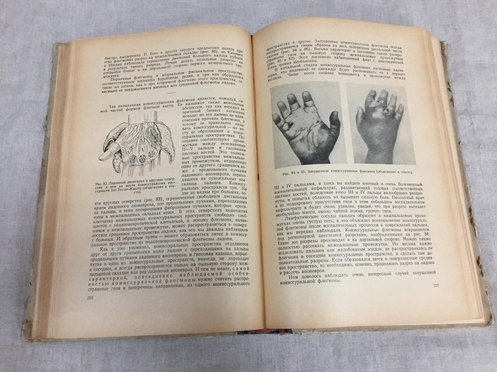 Очерки гнойной хирургии. Третье издание (1956) — фундаментальный труд В. Ф. Войно-Ясенецкого
