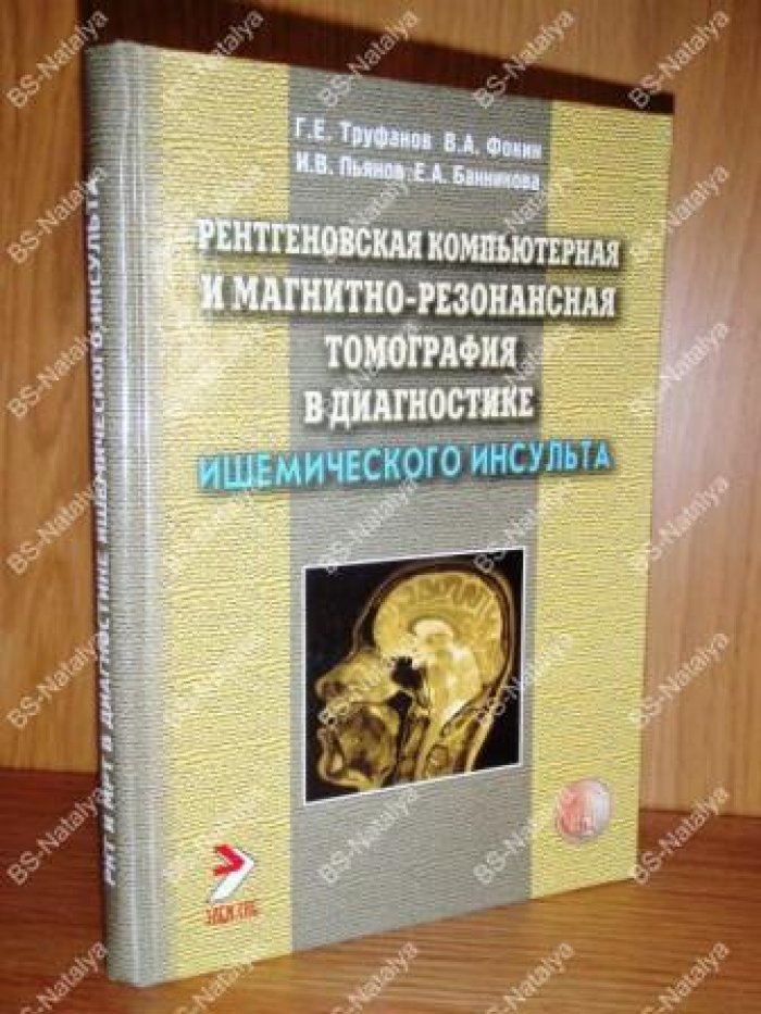 Труфанов Г.Е. Рентгеновская компьютерная и магнитно-резонансная томография в диагностике ишемического инсульта.