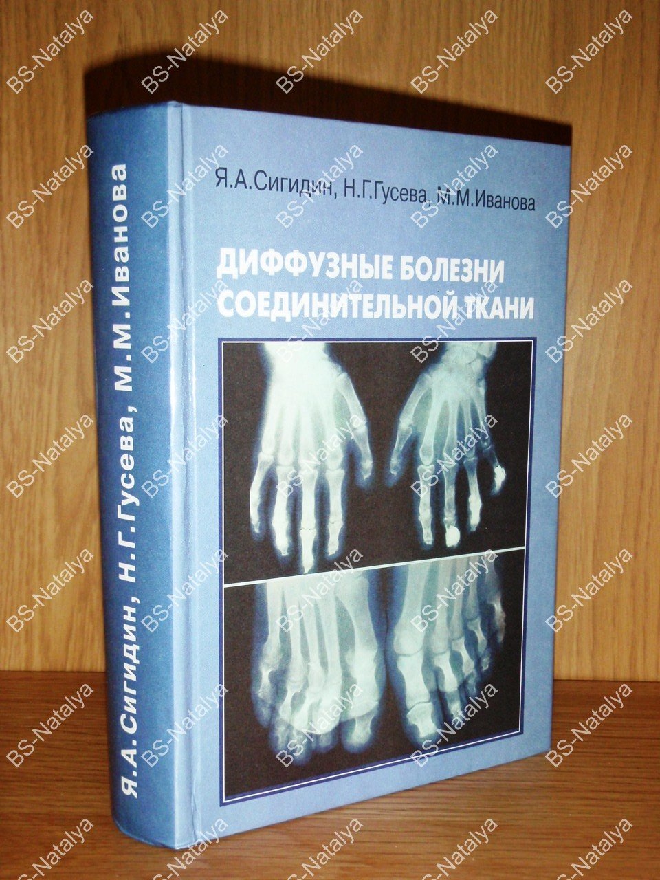Сигидин Я.А. Диффузные болезни соединительной ткани (Системные ревматические заболевания).