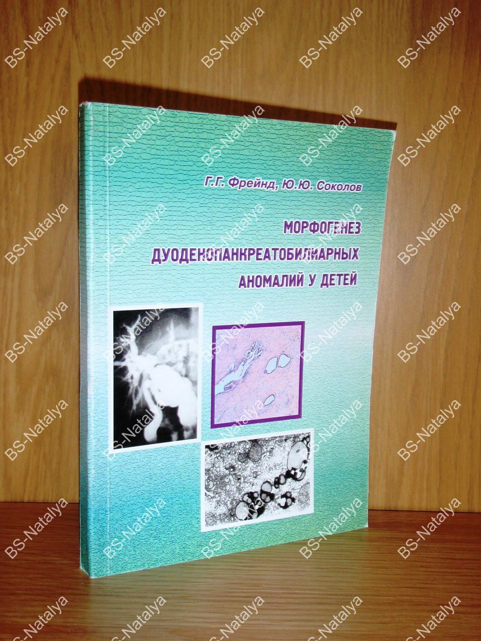 Фрейнд Г.Г., Соколов Ю.Ю. Морфогенез дуоденопанкреатобилиарных аномалий у детей.