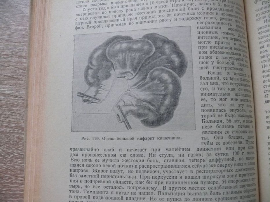 Мондор Г. Неотложная диагностика. Живот. В 2-х томах. Том второй.