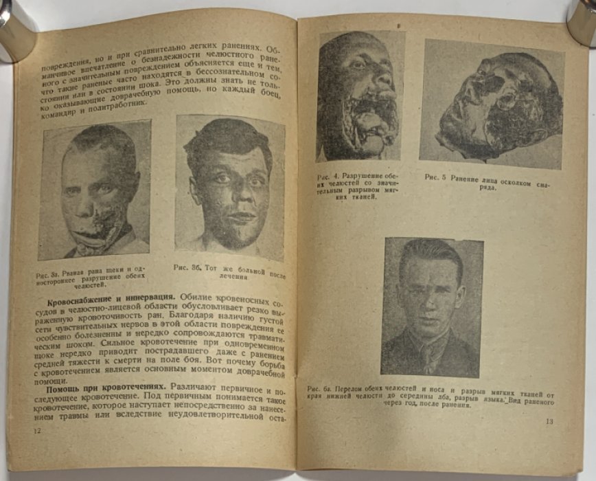 Энтин Д.А. Доврачебная медицинская помощь и уход при челюстно-лицевых ранениях.