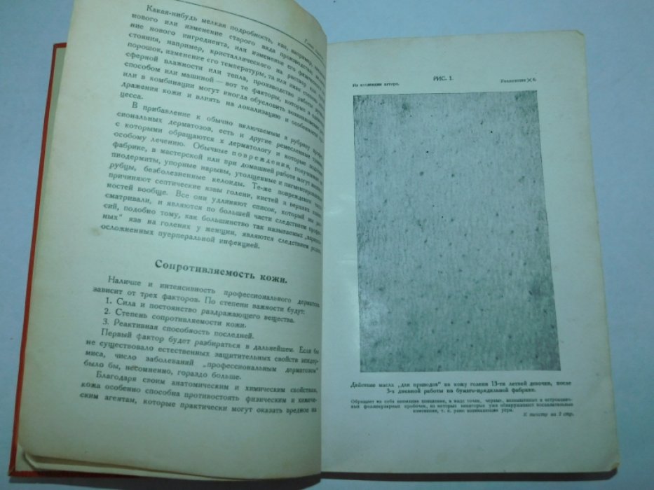 Прозер Уайт. Профессиональные поражения кожи. Их профилактика и лечение, с обращением внимания на производственные процессы и профессиональные вредности.