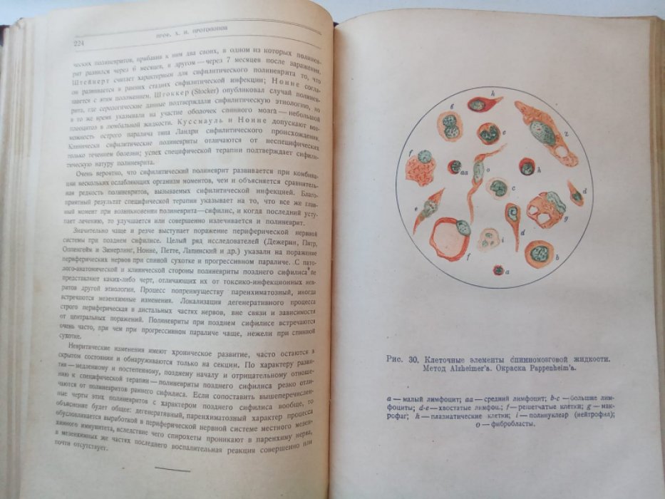Сифилис нервной системы.