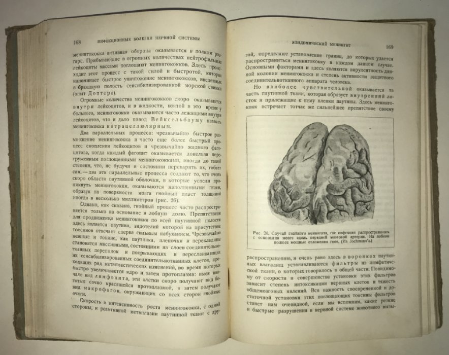 Сепп Е.К. Клинический анализ нервных болезней.