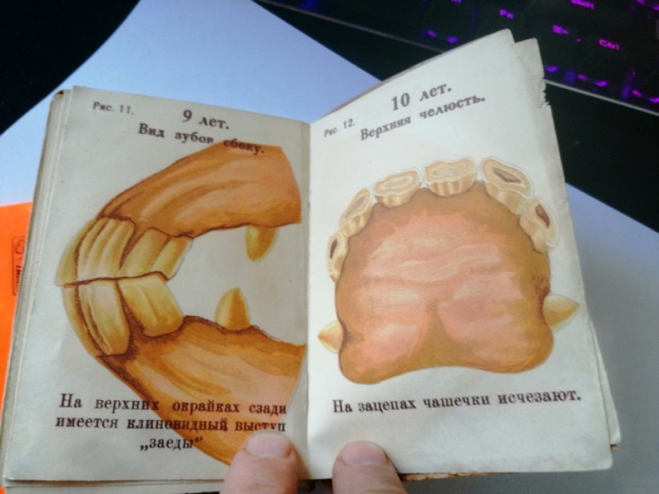 Определение возраста лошади по зубам.