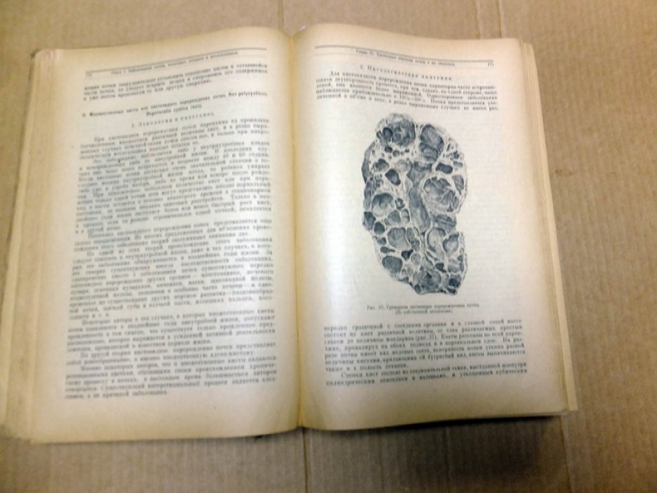 Хольцов Б. Н. Частная урология. В 5-ти выпусках в одном переплете (комплект).
