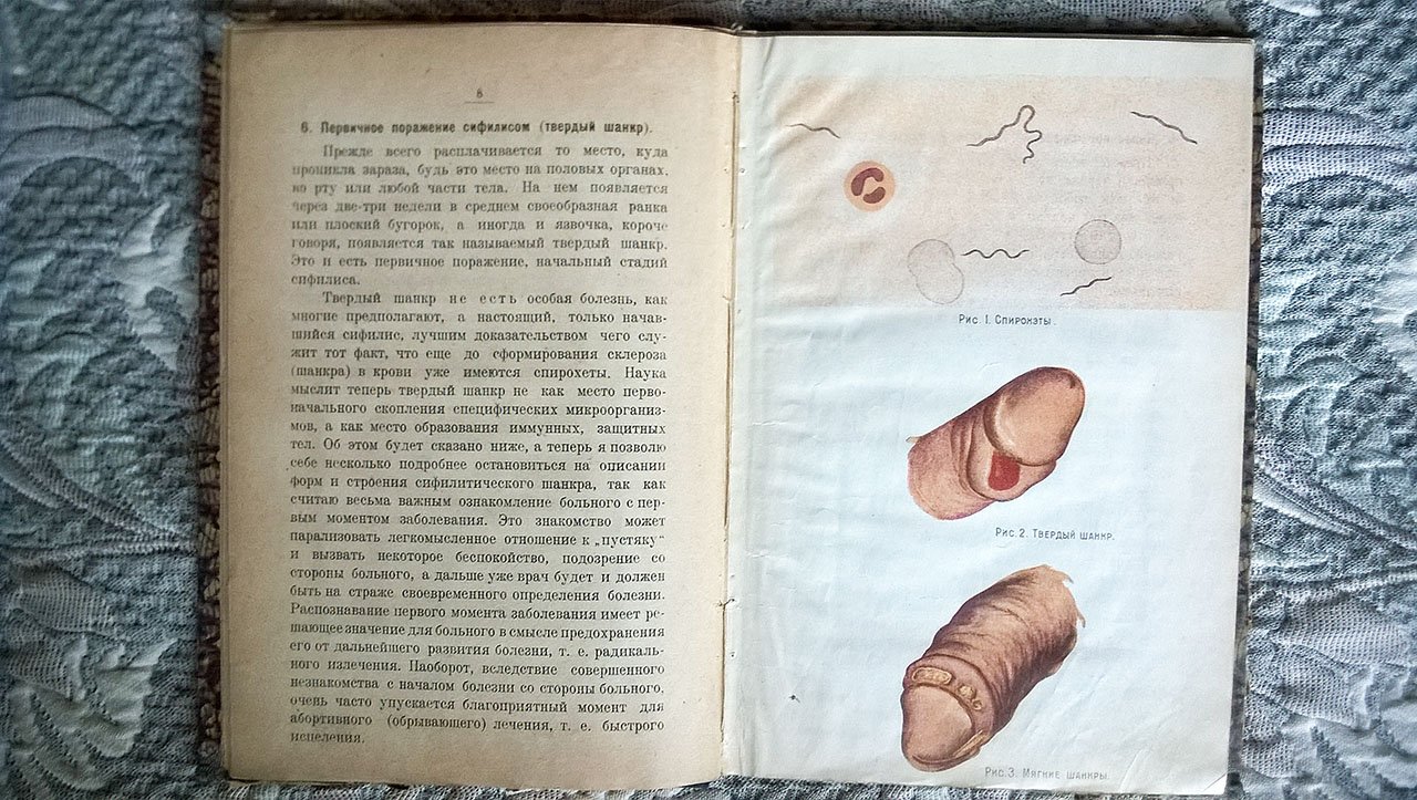 Гуревич Е.З. «Бич человечества» и борьба с ним [сифилис].