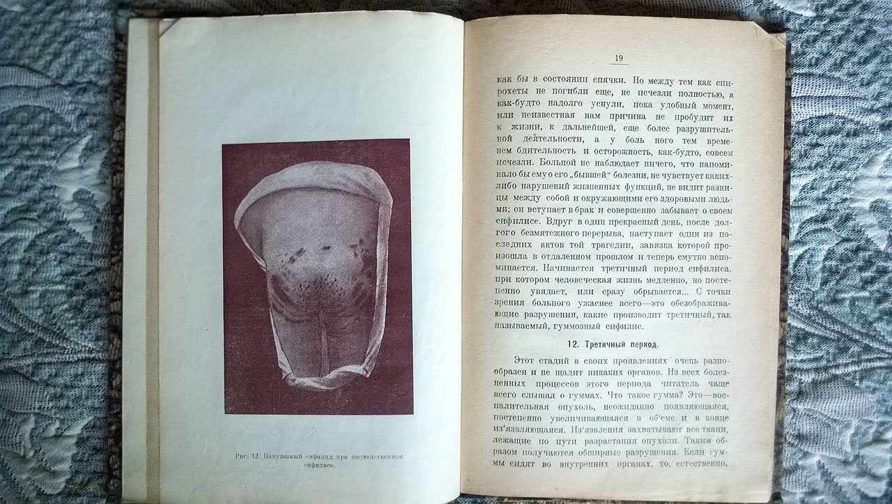 Гуревич Е.З. «Бич человечества» и борьба с ним [сифилис].