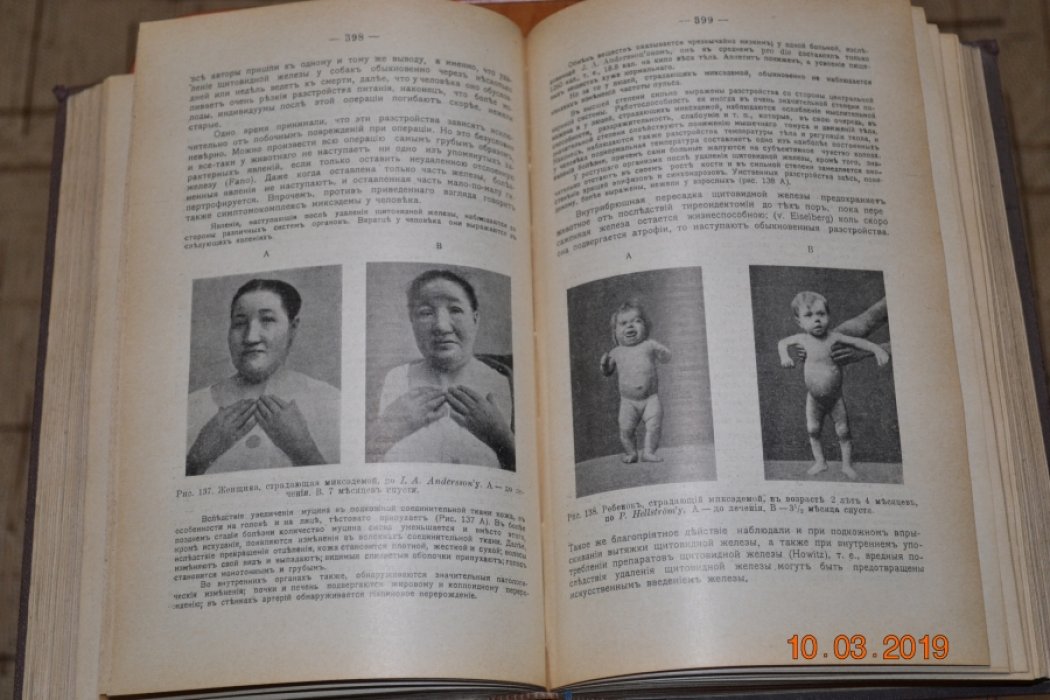 Robert Tigerstedt. Учебник физиологии человека. 2 тома в одном переплете.
