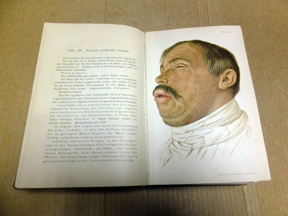 Franz Mrasek. Атлас кожных болезней (Atlas und Grundriss der Haut-Krankheiten).