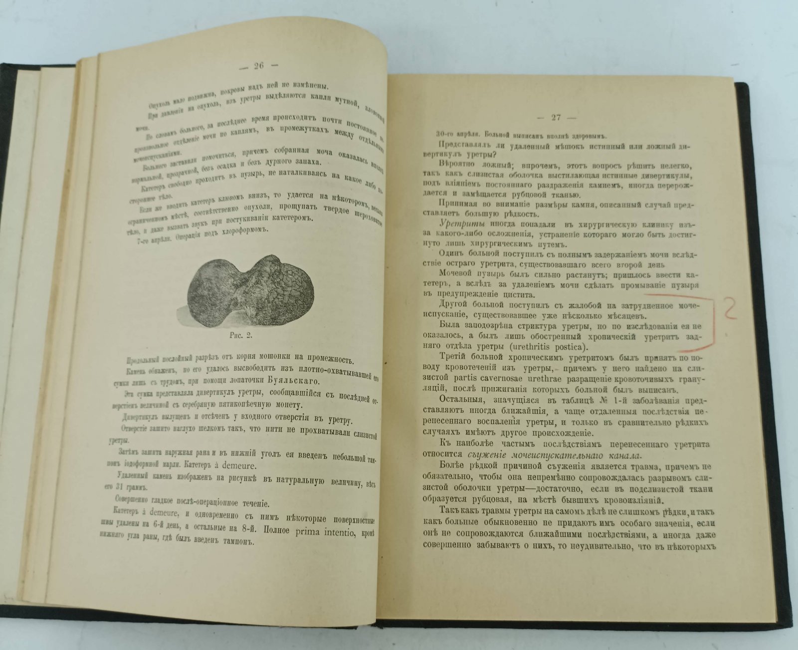 Войнич-Сяможеницкий А. Хирургические болезни мочеполовых органов.